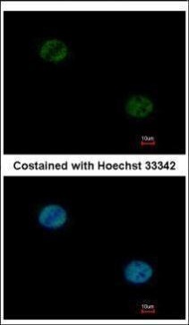 Immunofluorescence analysis of paraformaldehyde-fixed HeLa, using FOXA1(GRP458) antibody at 1:1000 dilution.