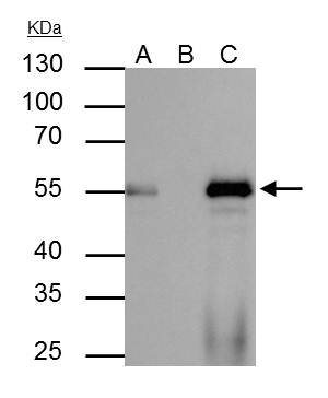 FOXA1 antibody immunoprecipitates FOXA1 protein in IP experiments. IP Sample: HepG2 whole cell lysate/extract A : 40 ?g whole cell lysate/extract of FOXA1 protein expressing HepG2 cells B : Control with 2.5 ?g of pre-immune rabbit IgG C : Immunoprecipitat
