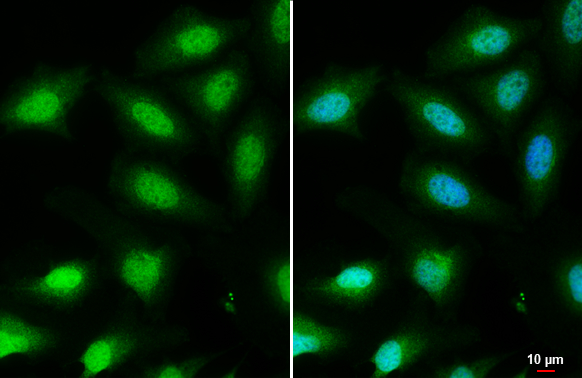 FOXO3A antibody [C3], C-term detects FOXO3A protein at nucleus by immunofluorescent analysis.Sample: HeLa cells were fixed in 4% paraformaldehyde at RT for 15 min.Green: FOXO3A stained by FOXO3A antibody [C3], C-term (GRP457) diluted at 1:1000.Blue: Hoech
