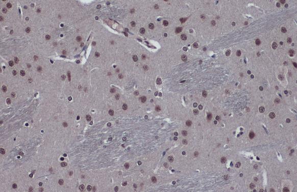 FOXO3A antibody [C3], C-term detects FOXO3A protein at cytoplasm and nucleus by immunohistochemical analysis.Sample: Paraffin-embedded rat brain.FOXO3A stained by FOXO3A antibody [C3], C-term (GRP457) diluted at 1:2000.Antigen Retrieval: Citrate buffer, p