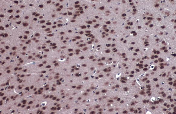 FOXO3A antibody [C3], C-term detects FOXO3A protein at cytoplasm and nucleus by immunohistochemical analysis.Sample: Paraffin-embedded mouse brain.FOXO3A stained by FOXO3A antibody [C3], C-term (GRP457) diluted at 1:2000.Antigen Retrieval: Citrate buffer,