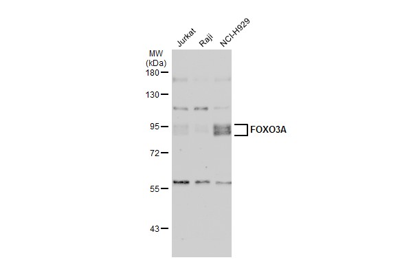 Various whole cell extracts (30 μg) were separated by 7.5% SDS-PAGE, and the membrane was blotted with FOXO3A antibody [C3], C-term (GRP457) diluted at 1:1000. The HRP-conjugated anti-rabbit IgG antibody  was used to detect the primary antibody.