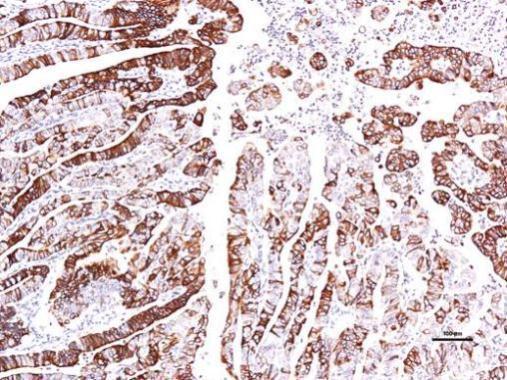 Immunohistochemical analysis of paraffin-embedded human endometrial, using GPR30(GRP493) antibody at 1:150 dilution.