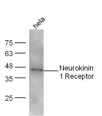IHC-P of GRP190
