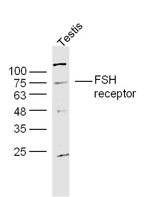 IHC-P of GRP318