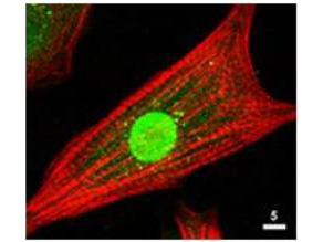 Anti-AKT Antibody - Immunofluorescence Microscopy