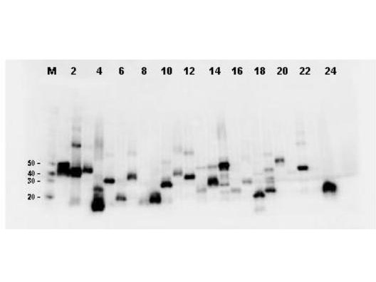 Monoclonal Antibody to detect FLAG™ conjugated proteins - Western Blot