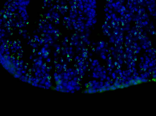 Immunofluorescence Microscopy - Mouse Anti-BrdU