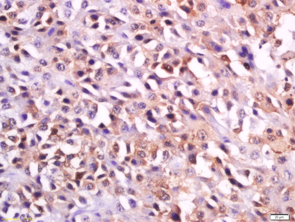 IHC-P of GRP571