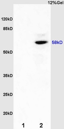 IHC-P of GRP198