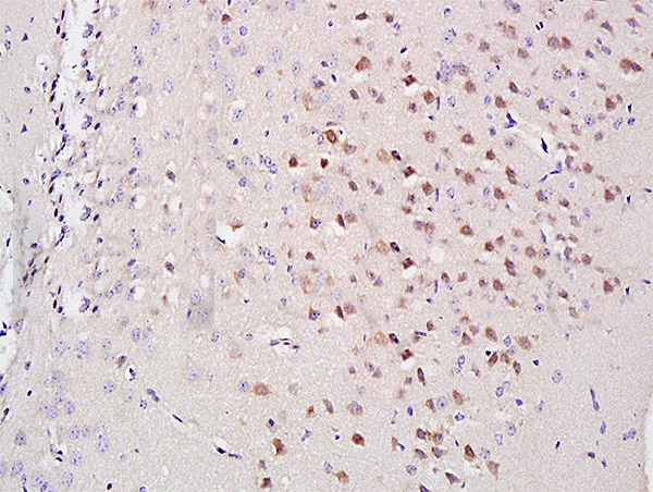 IHC-P of GRP578