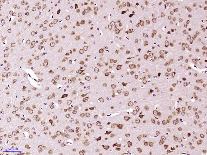 IHC-P of GRP615