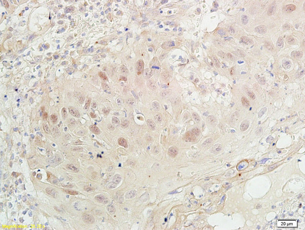 IHC-P of GRP624