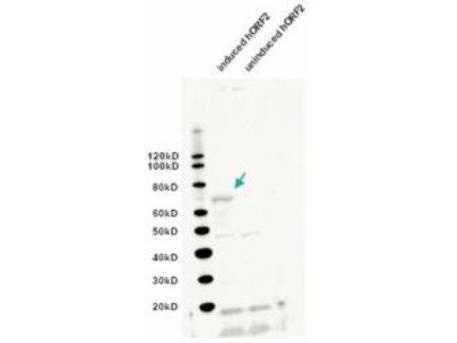 Anti-L1/ORF2 Antibody - Western Blot