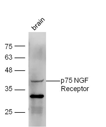 IHC-P of GRP207