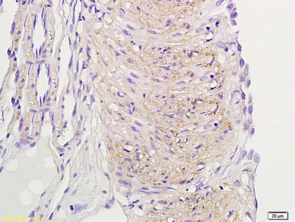 IHC-P of GRP386