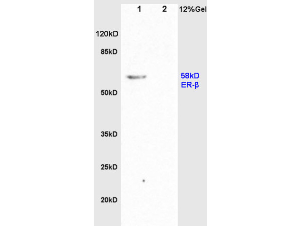 IHC-P of GRP211
