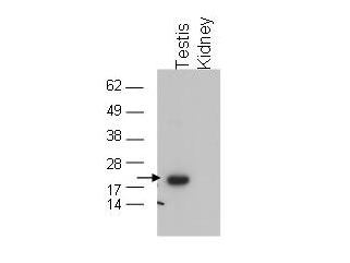 Anti-GPx4 Antibody - Western Blot
