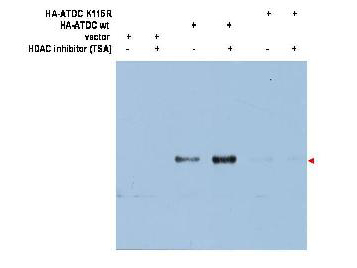 Anti-ATDC (Ac-K116) Antibody - Western Blot
