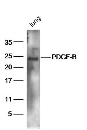 IHC-P of GRP214