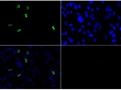 Histone H3 [Asym-dimethyl Arg2] Immunofluorescence