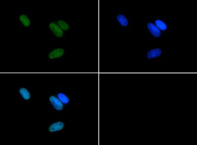 Histone H3 [Asym-dimethyl Arg17] Immunofluorescence