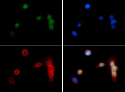 Histone H3 [Dimethyl Lys18] Immunofluorescence