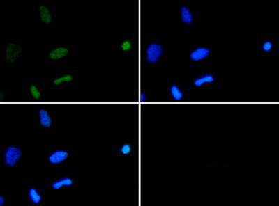 Histone H3 [ac Lys18]  Immunofluorescence