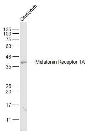 IHC-P of GRP184