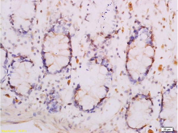 IHC-P of GRP452