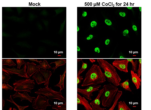 HIF1 alpha antibody detects HIF1 alpha protein at nucleus by immunofluorescent analysis.Sample: Mock and treated HeLa cells were fixed in 4% paraformaldehyde at RT for 15 min.Green: HIF1 alpha stained by HIF1 alpha antibody (GRP517) diluted at 1:500.Red: 