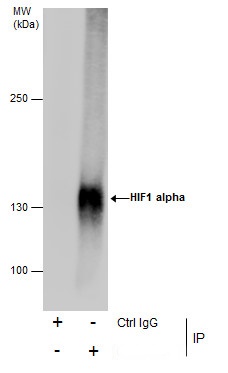 Immunoprecipitation of HIF1 alpha protein from HepG2 whole cell extracts treated with 500 ?M CoCl2 for 24 hr using 5 ?g of HIF1 alpha antibody (GRP517).Western blot analysis was performed using HIF1 alpha antibody (GRP517) diluted at 1:500.EasyBlot anti-R