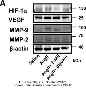 The WB analysis of HIF1 alpha antibody was published by Tsai SH and colleagues in the journal Sci Rep in 2016.PMID: 27363580