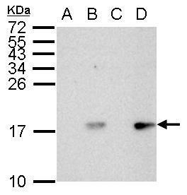 Histone H2A.X (phospho Ser139) antibody detects H2AFX protein by western blot analysis.A. 30 μg HCT116 whole cell lysate/extract (untreated for 2hr)B. 30 μg HCT116 whole cell lysate/extract (UVB treatment 50mJ for 2hr)C. 30 μg HCT116 whole cell l