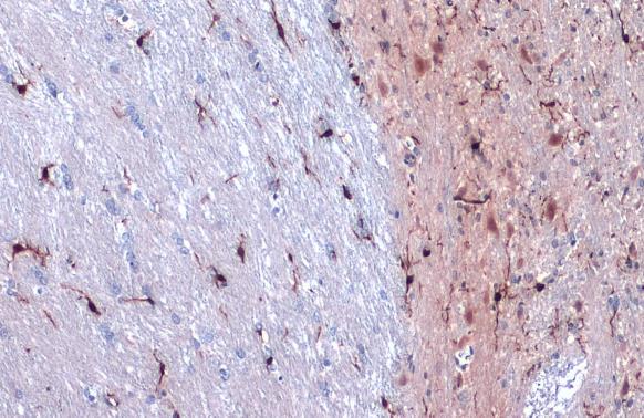 Iba1 antibody detects Iba1 protein at cell membrane and cytoplasm by immunohistochemical analysis.Sample: Paraffin-embedded rat cerebellum.Iba1 stained by Iba1 antibody (GRP545) diluted at 1:500.Antigen Retrieval: Citrate buffer, pH 6.0, 15 min
