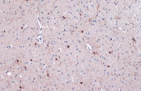 Iba1 antibody detects Iba1 protein at cell membrane and cytoplasm by immunohistochemical analysis.Sample: Paraffin-embedded mouse cerebellum.Iba1 stained by Iba1 antibody (GRP545) diluted at 1:500.Antigen Retrieval: Citrate buffer, pH 6.0, 15 min