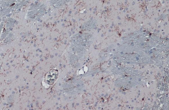 Iba1 antibody detects Iba1 protein at cytoplasm by immunohistochemical analysis.Sample: Paraffin-embedded rat brain.Iba1 stained by Iba1 antibody (GRP556) diluted at 1:2000.Antigen Retrieval: Citrate buffer, pH 6.0, 15 min