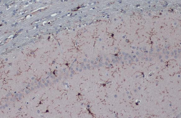 Iba1 antibody detects Iba1 protein at cytoplasm by immunohistochemical analysis.Sample: Paraffin-embedded rat brain.Iba1 stained by Iba1 antibody (GRP556) diluted at 1:2000.Antigen Retrieval: Citrate buffer, pH 6.0, 15 min