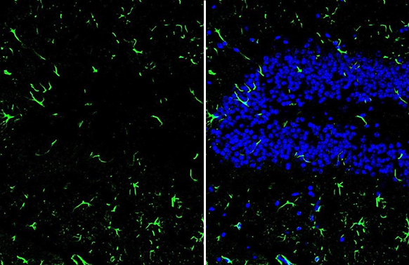 IL1 beta antibody detects IL1 beta protein at microglia by immunohistochemical analysis.Sample: Frozen-sectioned mouse hippocampus.Green: IL1 beta stained by IL1 beta antibody (GRP629) diluted at 1:250.Blue: Fluoroshield with DAPI.