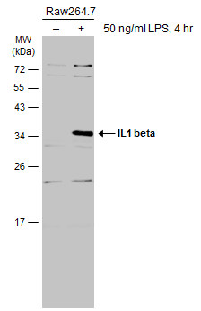 Untreated (â€“) and treated (+) Raw264.7 whole cell extracts (30 μg) were separated by 12% SDS-PAGE, and the membrane was blotted with IL1 beta antibody (GRP629) diluted at 1:1000. The HRP-conjugated anti-rabbit IgG antibody  was used to detect the pri