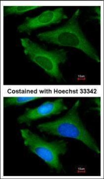 Immunofluorescence analysis of methanol-fixed HeLa, using IL1ra  antagonist (GRP571) antibody at 1:200 dilution.
