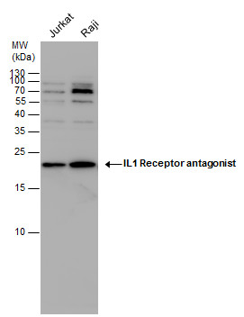 IL1 Receptor antagonist antibody detects IL1 Receptor antagonist protein by Western blot analysis. Various whole cell extracts (30 ?g) were separated by 15 % SDS-PAGE, and blotted with IL1 Receptor antagonist antibody (GRP571) diluted by 1:1000