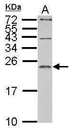 IL1 Receptor antagonist antibody detects IL1RN protein by western blot analysis.A. 30 μg PC-12 whole cell lysate/extract15% SDS-PAGEIL1 Receptor antagonist antibody (GRP571) dilution: 1:1000 The HRP-conjugated anti-rabbit IgG antibody  was used to dete