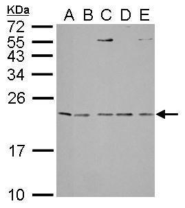 IL1 Receptor antagonist antibody detects IL1RN protein by western blot analysis.A. 30 μg Neuro2A whole lysate/extract B. 30 μg C8D30 whole cell lysate/extract C. 30 μg NIH-3T3 whole cell lysate/extract D. 30 μg Raw264.7 whole cell lysate/extra