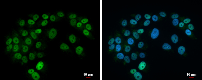 Islet 1 antibody detects Islet 1 protein at nucleus by immunofluorescent analysis.Sample: SK-N-AS cells were fixed in 4% paraformaldehyde at RT for 15 min.Green: Islet 1 protein stained by Islet 1 antibody (GRP563) diluted at 1:500.Blue: Hoechst 33342 sta