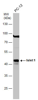 Whole cell extract (30 μg) was separated by 10% SDS-PAGE, and the membrane was blotted with Islet 1 antibody (GRP563) diluted at 1:1000. The HRP-conjugated anti-rabbit IgG antibody  was used to detect the primary antibody.