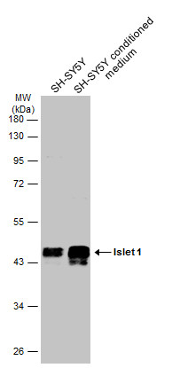 SH-SY5Y whole cell and nuclear extracts (30 μg) were separated by 10% SDS-PAGE, and the membrane was blotted with Islet 1 antibody (GRP563) diluted at 1:10000. The HRP-conjugated anti-rabbit IgG antibody  was used to detect the primary antibody.