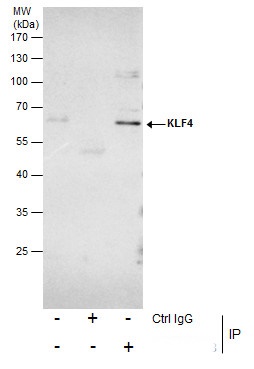 Immunoprecipitation of KLF4 protein from HeLa whole cell extracts using 5 ?g of KLF4 antibody (GRP475).Western blot analysis was performed using KLF4 antibody (GRP475) diluted at 1:500.EasyBlot anti-Rabbit IgG  was used as a secondary reagent.