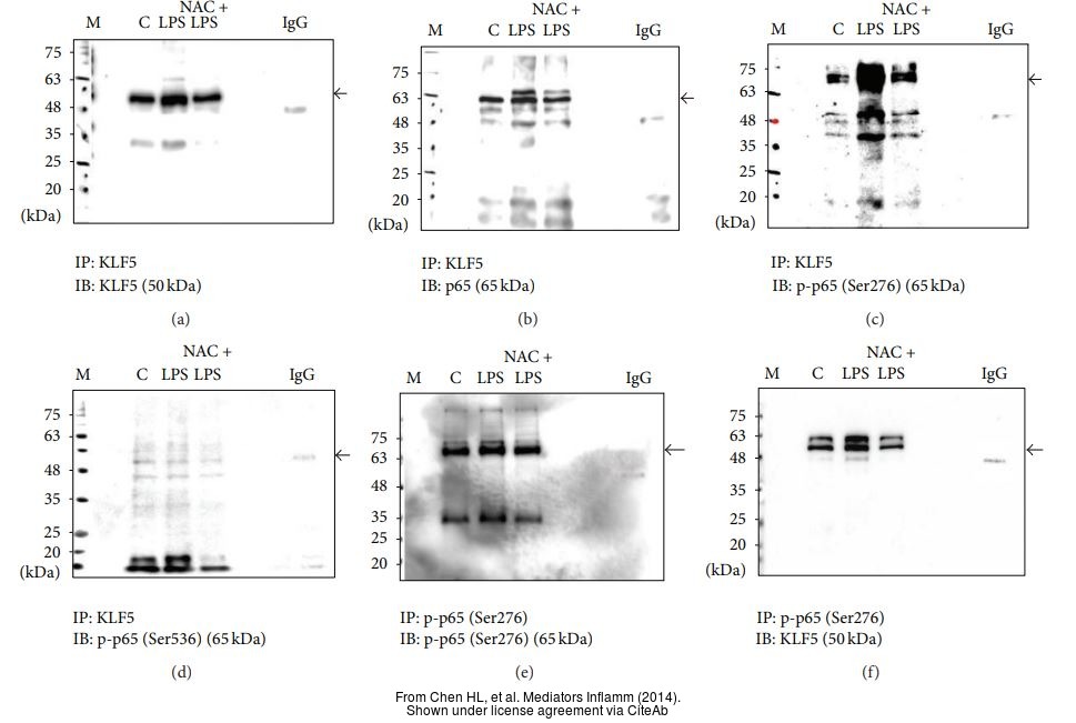 The WB, IP analysis of KLF5 antibody was published by Chen HL and colleagues in the journal Mediators Inflamm in 2014.PMID: 25197166