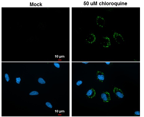 LC3B antibody [GT3612] detects LC3B protein at autophagosome by immunofluorescent analysis. Samples: HeLa cells mock (left) and treated with 50?M Chloroquine for 24 hr (right) were fixed in 4% paraformaldehyde at RT for 15 min.Green: LC3B protein stained 